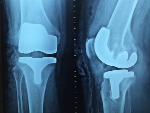Wady postawy - konsultacja u ortopedy